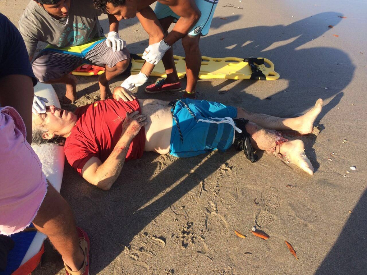 Stab Magazine Crocodile Attacks Surfer In Costa Rica Warning Graphic Imagery Inside